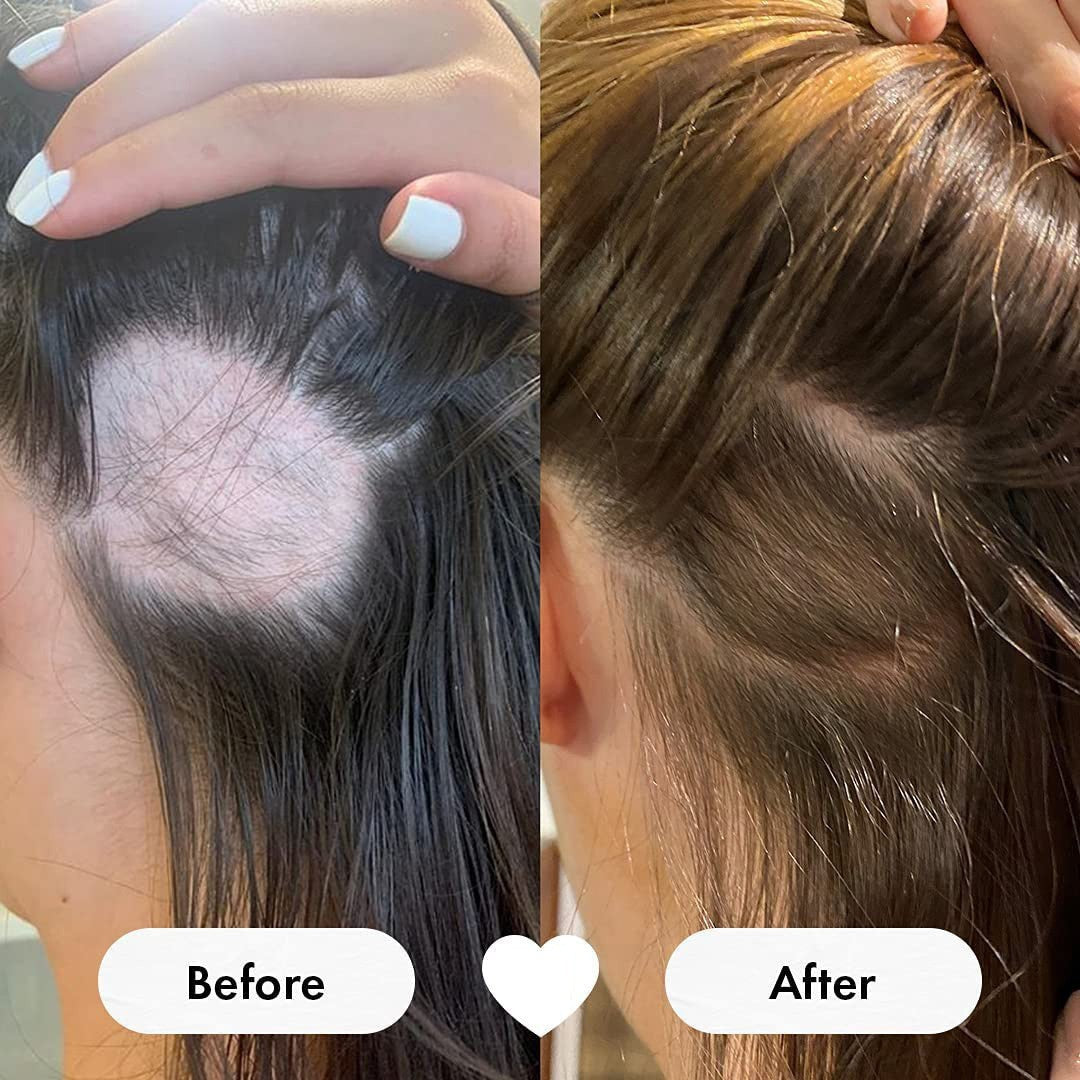 Biotin Gummies - 60 pcs