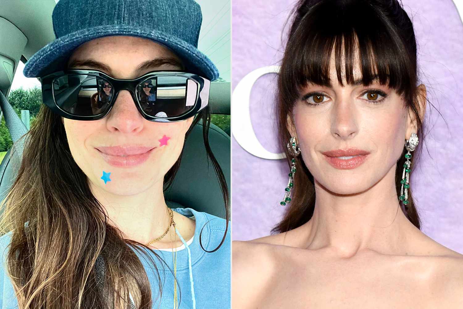 Pimple Patch - 180 Pcs